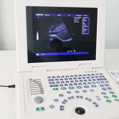 kwaliteit GYN Factory Supply Dw580 Portable Ultrasound Machine For Sale fabriek